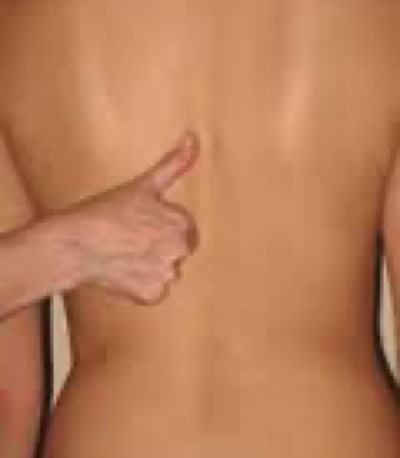 Afbeelding Dorntherapie